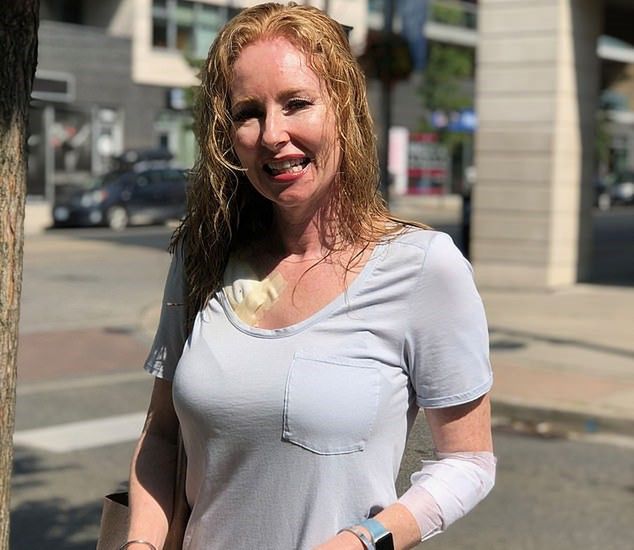 Kobieta przyznaje, że unikała kremów z filtrem