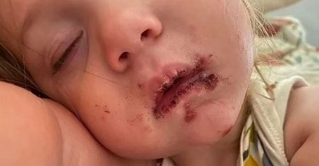 Jej córka została pocałowana w usta. Mama ostrzega rodziców
