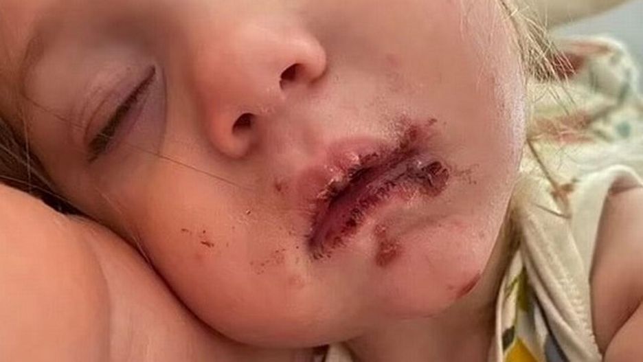 Jej córka została pocałowana w usta. Mama ostrzega rodziców