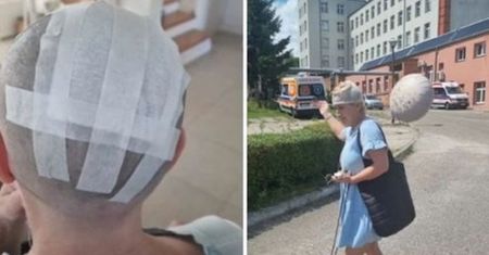 Przycinał gałęzie. Piła rozcięła głowę przechodnia