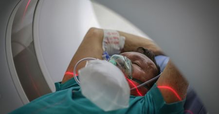 Tak COVID atakuje mózg. Widoczne zmiany zapalne