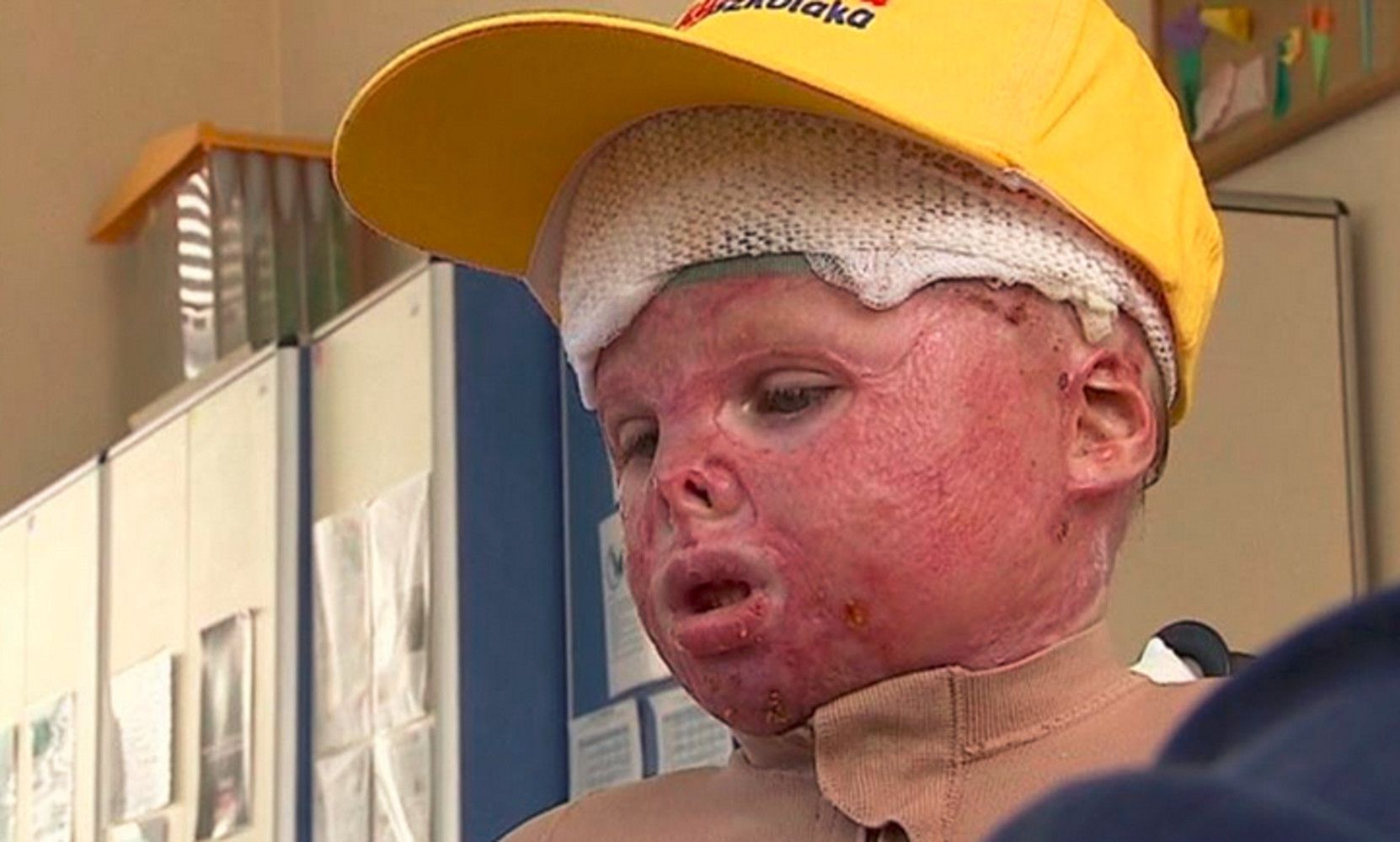 Mateuszek - chłopiec, który ocalał z pożaru