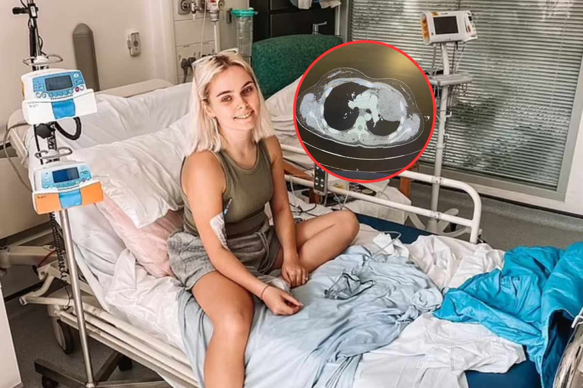 Cierpiała z powodu nocnych potów. RTG ujawniło guzy, ale to nie był rak płuc