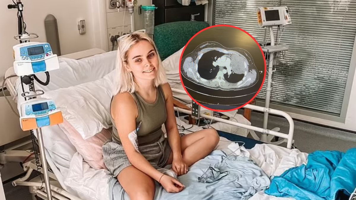 U 24-latki zdiagnozowano chłoniaka