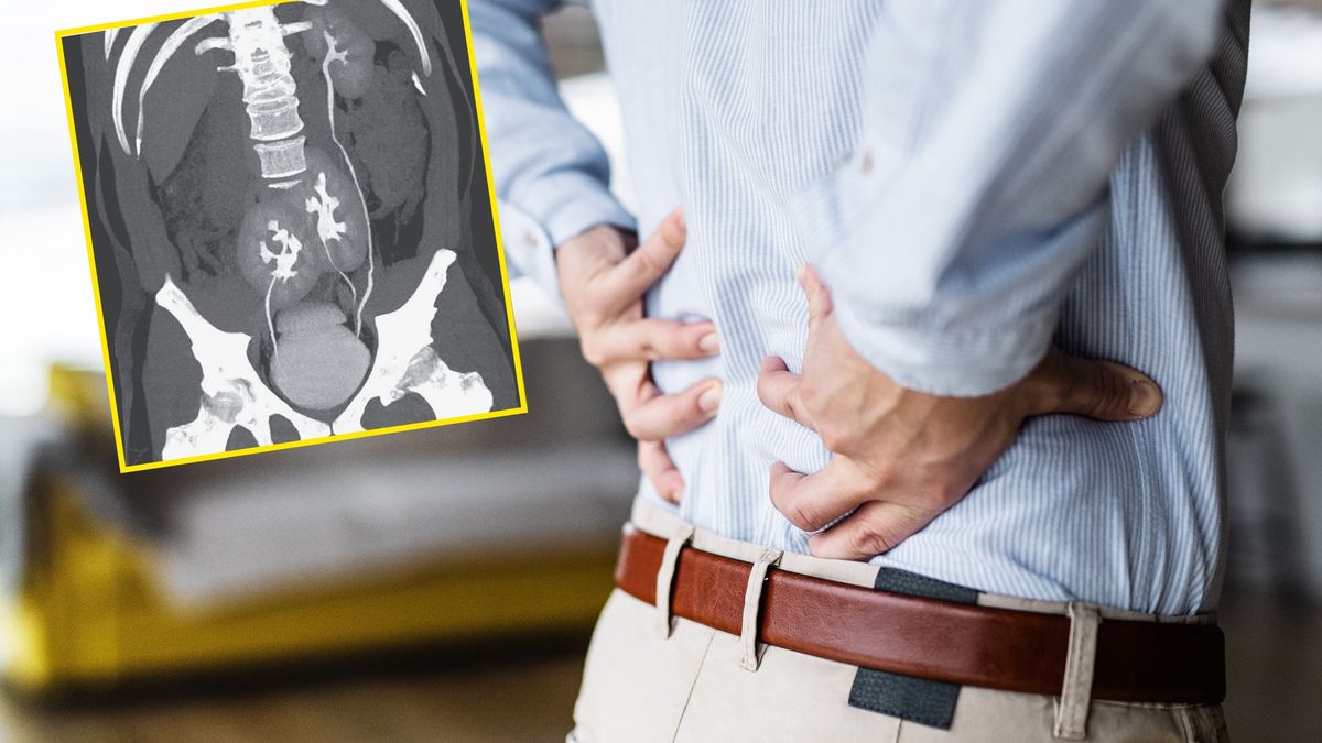 Lekarze znaleźli coś nietypowego na obrazie tomograficznym 