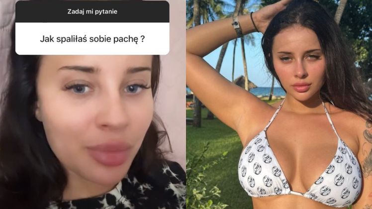 Fagata żali się na poparzoną pachę 