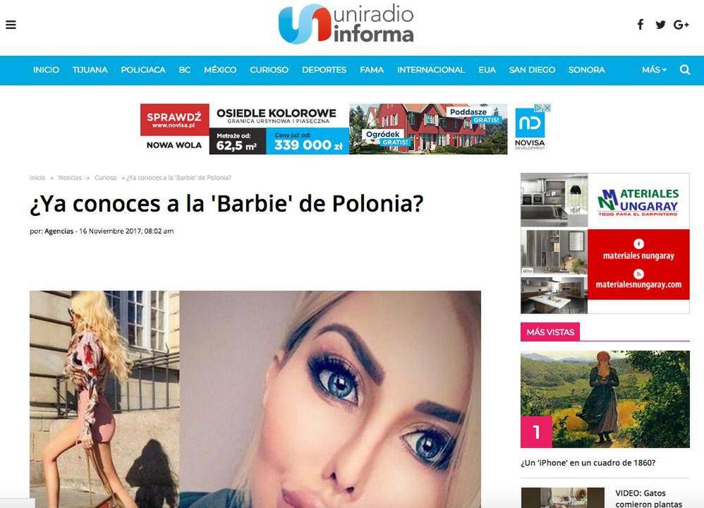 Anella (Polska żywa Barbie) w zagranicznych mediach