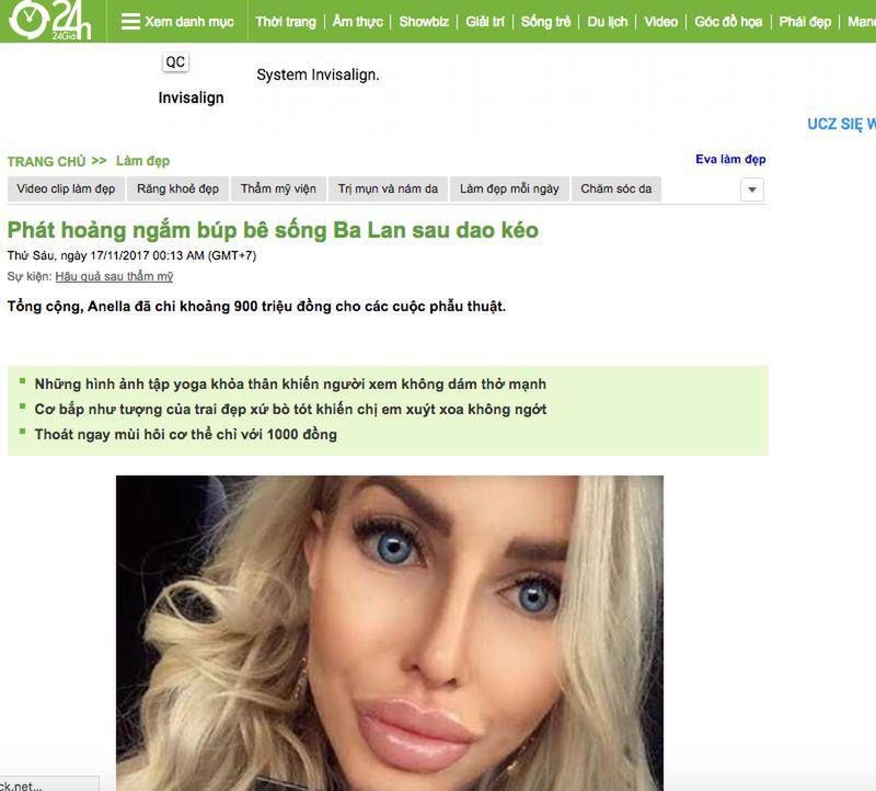 Anella (Polska żywa Barbie) w zagranicznych mediach