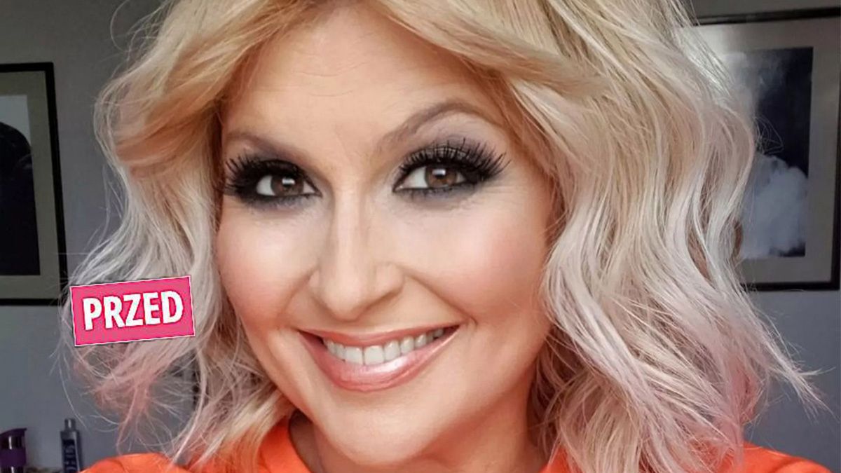 Katarzyna Skrzynecka zafundowała sobie metamorfozę