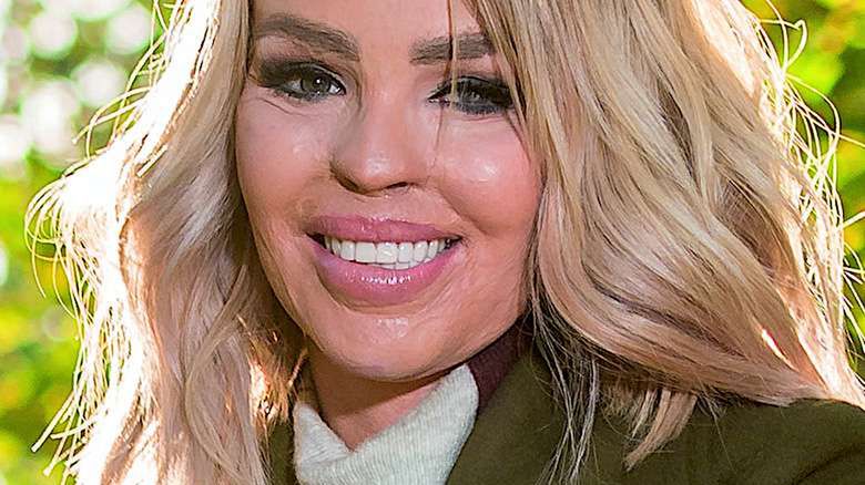 Katie Piper bez makijażu