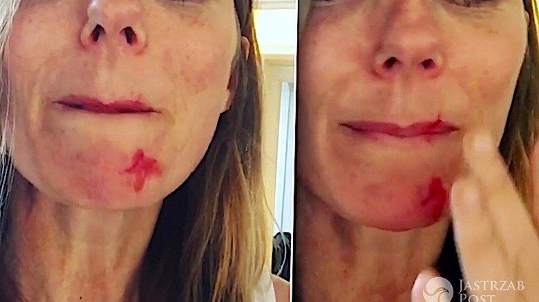 Geri Halliwell podrapana przez kota