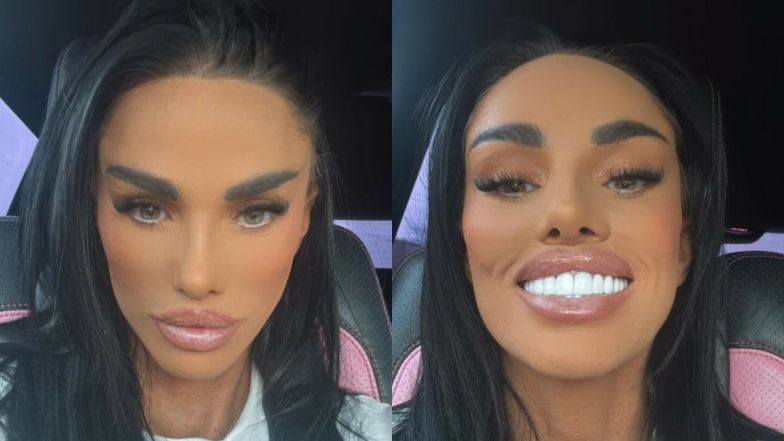 Katie Price prezentuje nowy nos i oślepia białymi licówkami