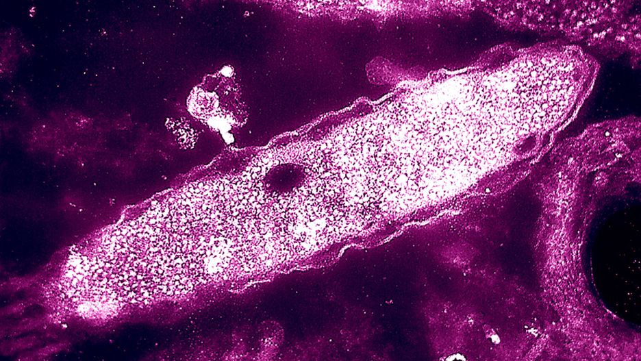 Legionella rozlewa się po Polsce