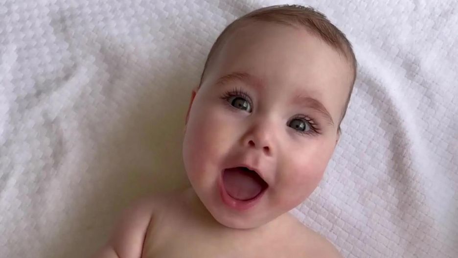 Nowa twarz Gerbera 2022. Dziewczynka urodziła się z wadą wrodzoną kończyn