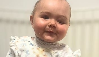 "Moja roczna córeczka umiera". Dramat maleńkiej Lany