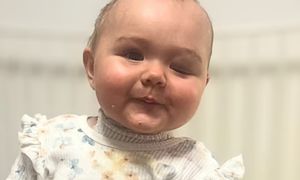 "Moja roczna córeczka umiera". Dramat maleńkiej Lany