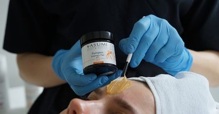 Masz tłustą, trądzikową cerę? Terapia z dynią załatwi problem