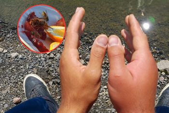 Groźny owad już grasuje. "Wpuszcza dużo jadu do organizmu"