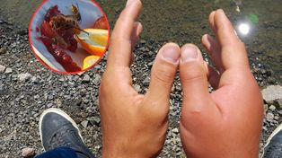 Groźny owad już grasuje. "Wpuszcza dużo jadu do organizmu"