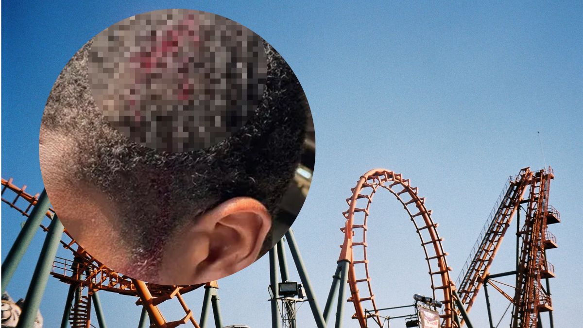 David Carter doznał wstrząsu mózgu, a z jego głowy długo sączyła się krew