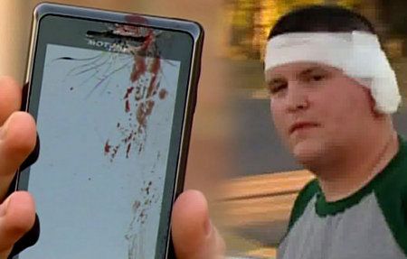 Co może zrobić z uchem eksplodujący telefon komórkowy? 1