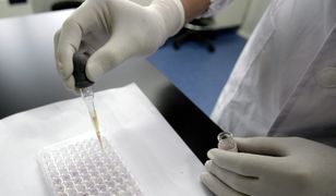 Rośnie liczba zakażeń HIV. "To wina wpływów Rosji"