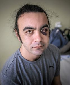 Lublin: pobicie studenta z Turcji