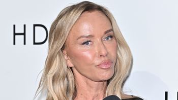 Joanna Przetakiewicz ujawnia, jakie zabiegi sobie ostatnio zrobiła: "Jestem jeszcze cały czas SPUCHNIĘTA"