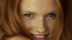 Skóra - zdrowie wypisane na skórze, trądzik, zmarszczki, trądzik różowaty, egzema