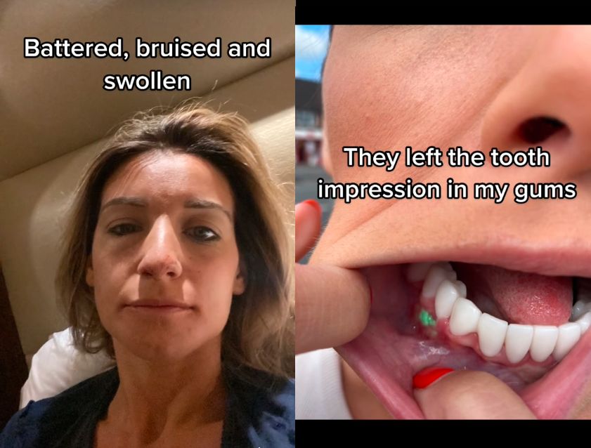 Turecka metamorfoza z piekła rodem