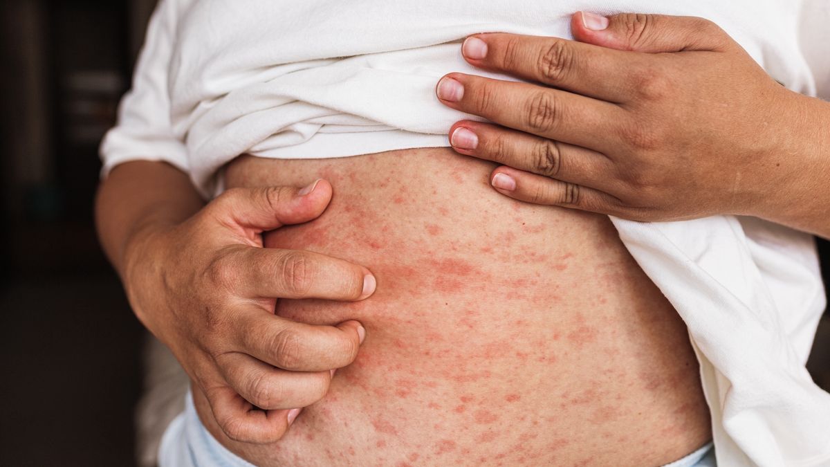 Jakie są objawy niedoboru witaminy B2?