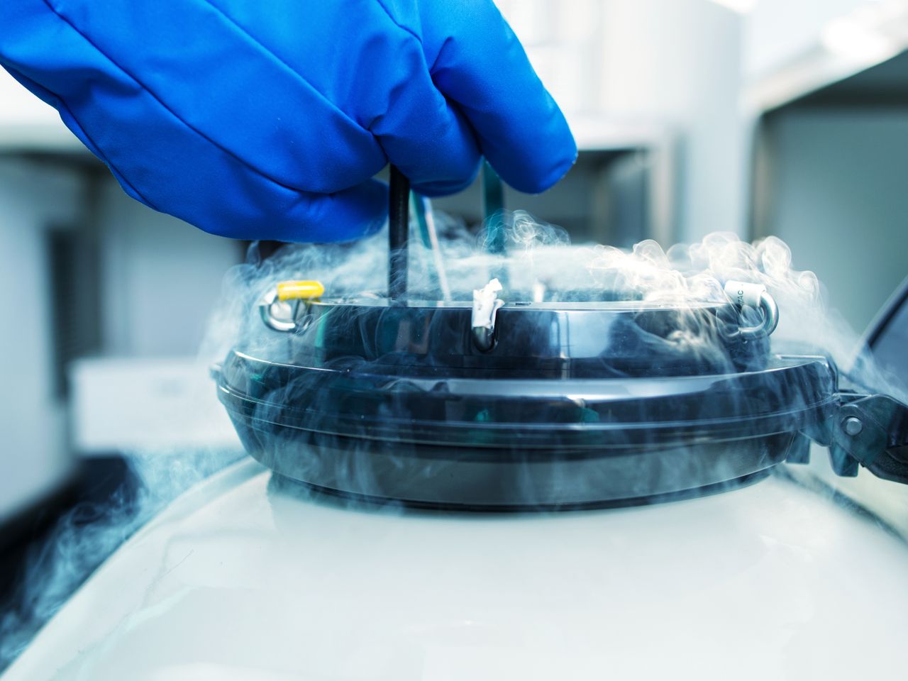 Australia's first cryonics patient frozen in a groundbreaking procedure
