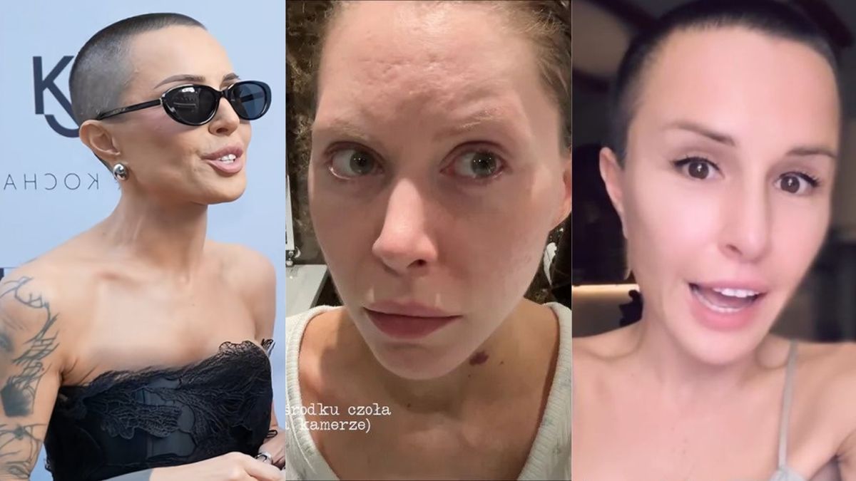 Blanka Lipińska o liftingu
