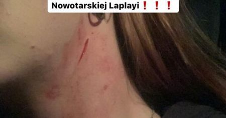 Brutalny atak na Podhalu. "Rzucił w krzaki i zaczął dusić"