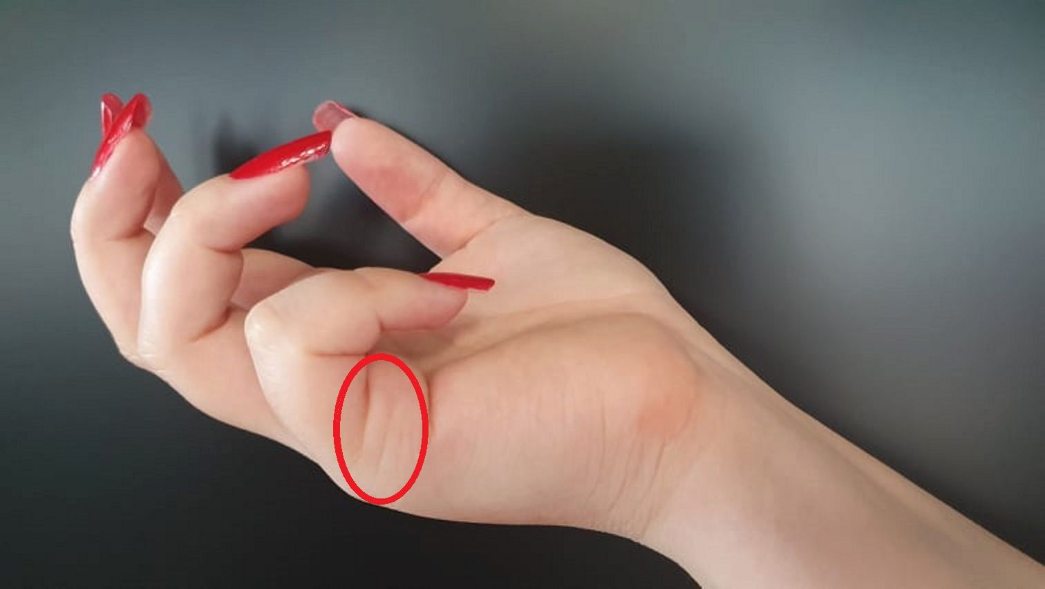 Linia znajduje się bezpośrednio pod małym palcem