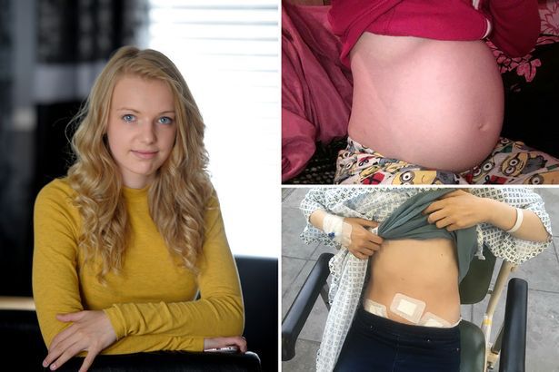 (gazettelive.co.uk) Brzuch Bethany wielkością przypominał brzuch kobiety w 6 miesiącu ciąży