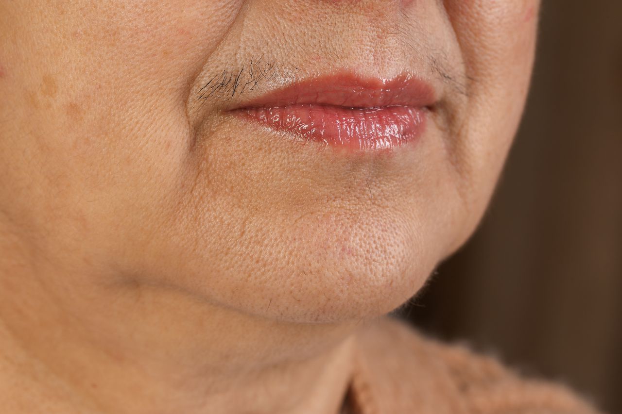 Skąd owłosienie twarzy po menopauzie?