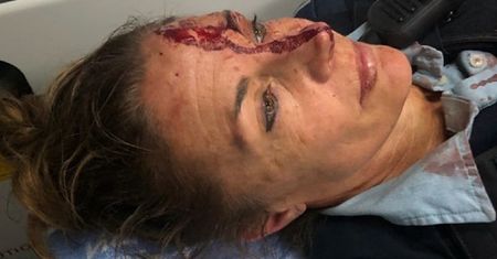 Australia. 28-latek zaatakował policjantkę. I to dwa razy