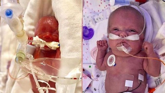 Grace skończyła 3 miesiące