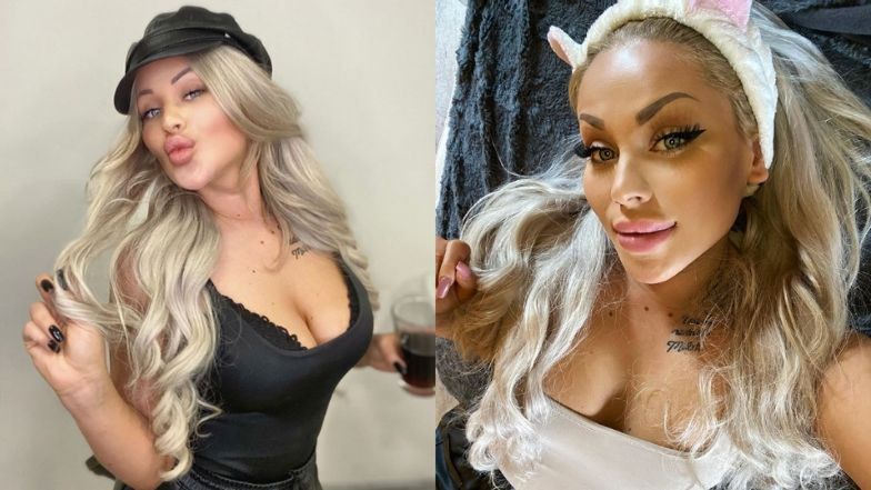 Ewel0na planuje kolejne operacje plastyczne