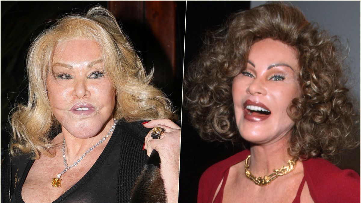 Jocelyn Wildenstein w 2024 i 1999 roku