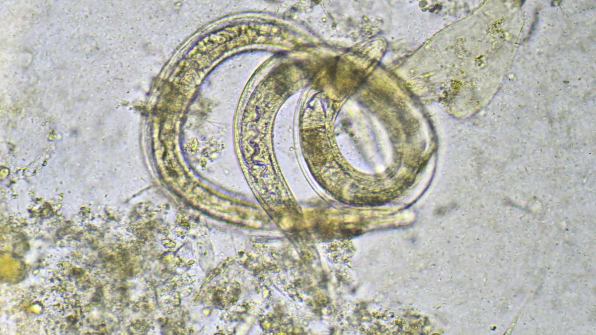 Zarażenie pasożytami jest możliwe po spożyciu nieumytych owoców lub surowego mięsa.