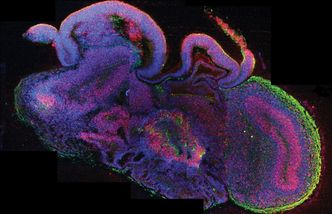 Miniaturowe ludzkie mózgi z próbówki