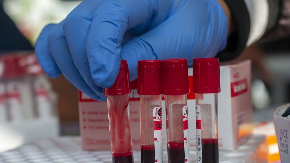 Health workers arrange a teen's blood sample for the Human Immunodeficiency Virus (HIV) test in Palu, Central Sulawesi, Indonesia on August 15, 2019. The test initiated by the local Health Service was intended to identify adolescents suffering from HIV and prevention efforts for transmission as early as possible. (Photo by Basri Marzuki/NurPhoto via Getty Images)