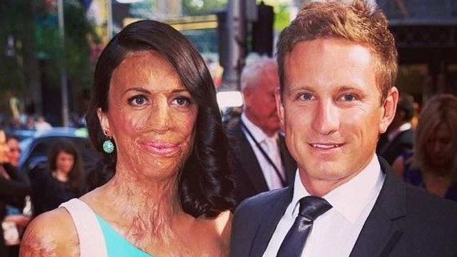 Turia Pitt i jej mąż