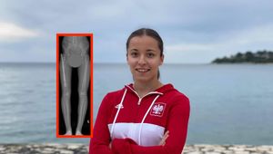 Lekarz tylko spojrzał na jej nogę. Sam wysłał do niej wiadomość