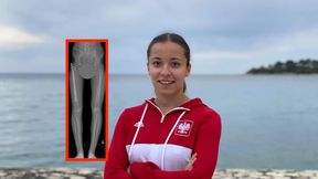 Lekarz tylko spojrzał na jej nogę. Sam wysłał do niej wiadomość