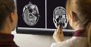 Próby transplantacji głowy. Eksperymenty zaczęto jeszcze na początku XX wieku
