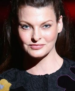 "Brutalnie oszpecona". Linda Evangelista pokazała fragment swojego ciała