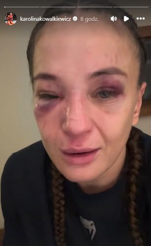 Karolina Kowalkiewicz po walce w Rio